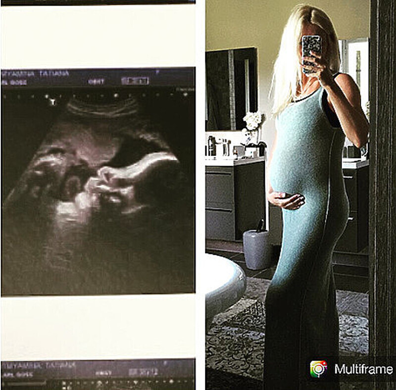 За несколько дней до родов Алексей выложил снимок УЗИ маленькой Мишель.Фото: инстаграм