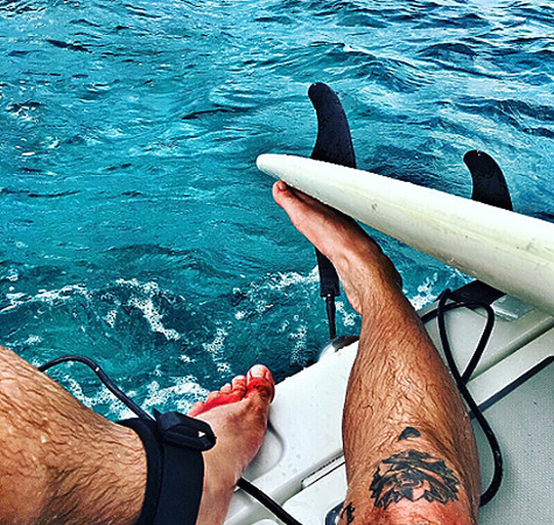 Во время катания на серфе Тимати укусила барракуда. Фото: Instagram.com/timatiofficial.