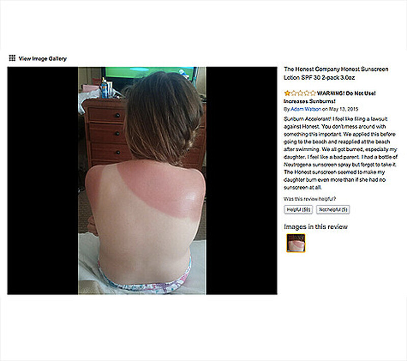 Возмущенные покупатели приложили к иску фотографии своих обгоревших детей. Фото: cdn.kidspot.com.au.