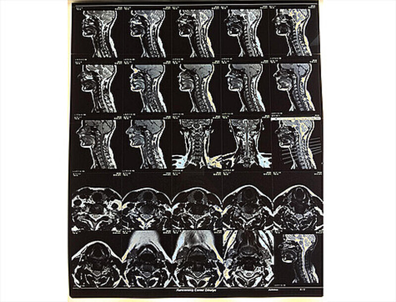 Мария Кожевникова показала подписчикам свои рентгеновские снимки. Фото: Instagram.com/mkozhevnikova.