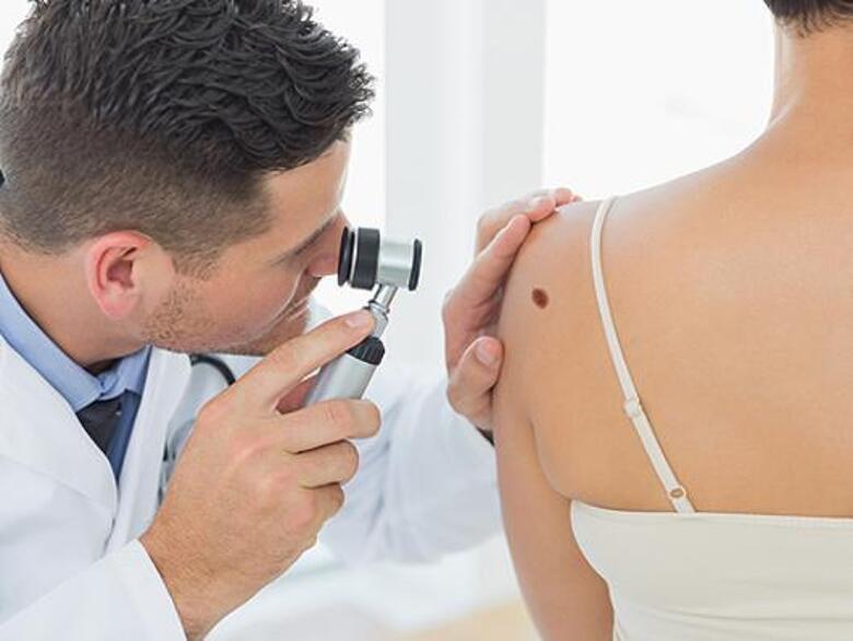 Как отличить родинку от меланомы? Фото: Lori.ru.