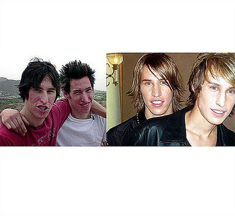 Близнецы Майк и Мэтт Шлепп в своем желании стать похожими на Брэда Питта обратились в передачу канала MTV «Я хочу лицо знаменитости». Фото: blogs.publico.es.