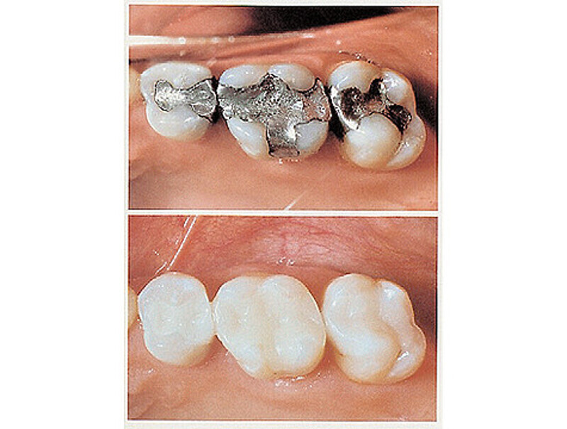 «Сам процесс моделирования происходит при 12- кратном увеличении, где  врач может самостоятельно задавать огромное количество самых подробных параметров». Фото: материалы пресс-служб.