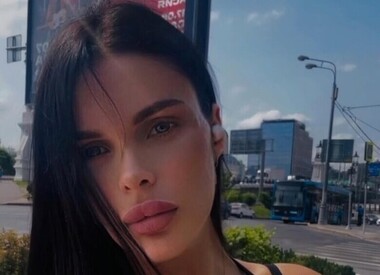 Оставшаяся без части черепа модель Анжелика Тартанова простила своего сожителя